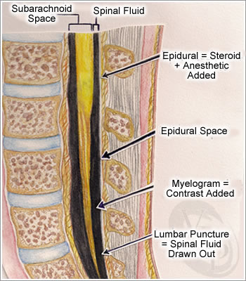 Group 4 steroid